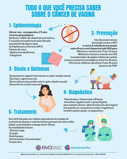 Tudo o que você precisa saber sobre o câncer de vagina